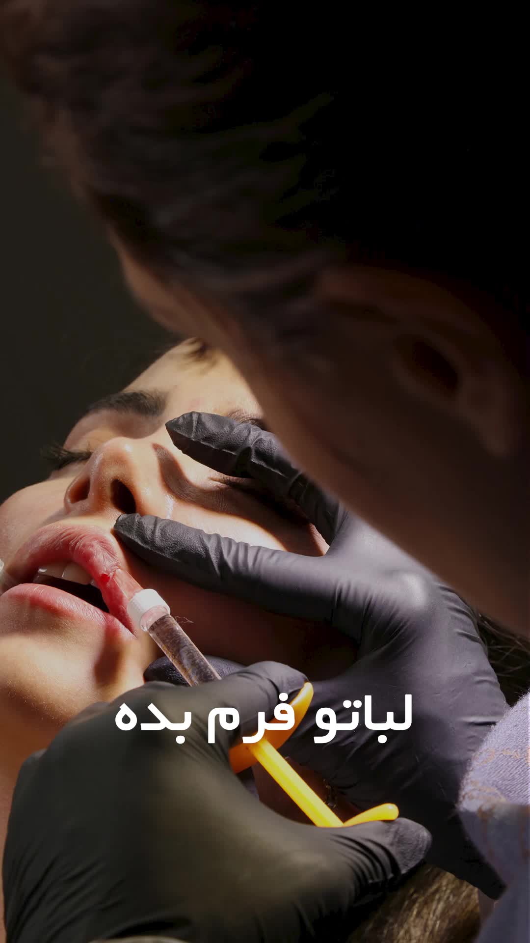 جشنواره ویژه کلینیک تخصصی پوست و مو  شوکت|خدمات آرایشگری و زیبایی|تهران, اوقاف|دیوار