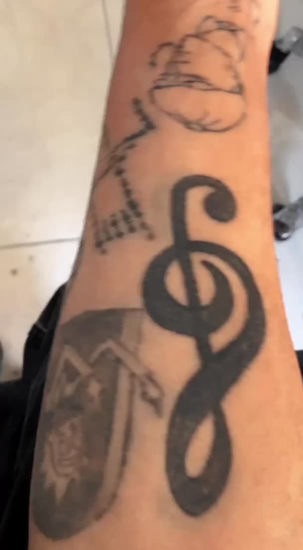 ریموو تاتو صورت و بدن با لیزر کیوسوییچ امریکایی|خدمات آرایشگری و زیبایی|گرگان, |دیوار