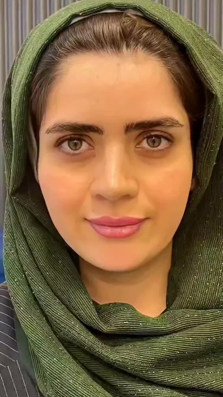 شگفتانه قیمت فیلر و بوتاکس فقط تا پایان هفته|خدمات آرایشگری و زیبایی|رشت, گلسار|دیوار