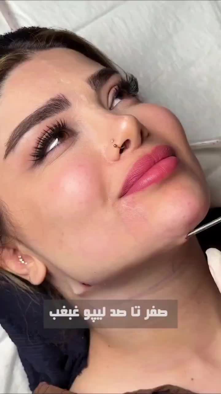 آف50%ساکشن غبغب سوپرکانتورVLineژل بینی زاویه دائمی|خدمات زیبایی و سلامت|مشهد, هفت تیر (آب و برق)|دیوار