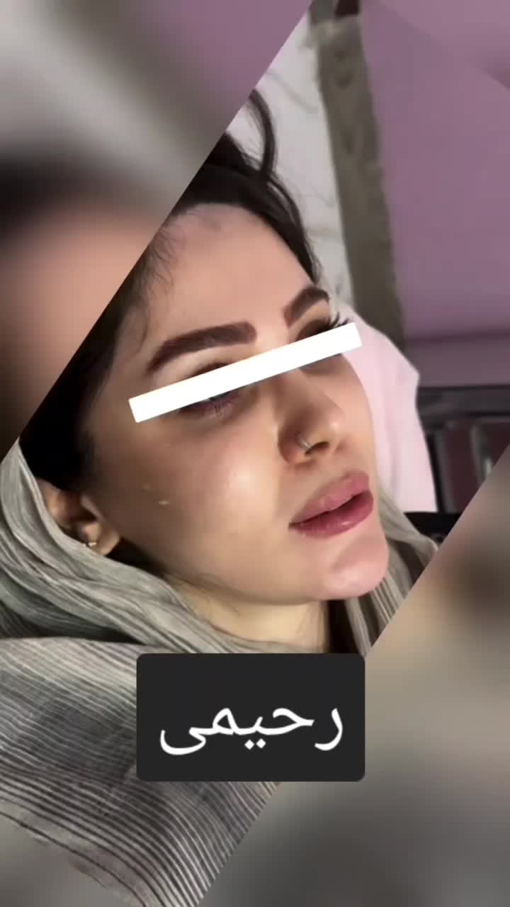 تزریق (ژل،بوتاکس،نخ)قیمت مناسب|خدمات آرایشگری و زیبایی|ملارد, |دیوار