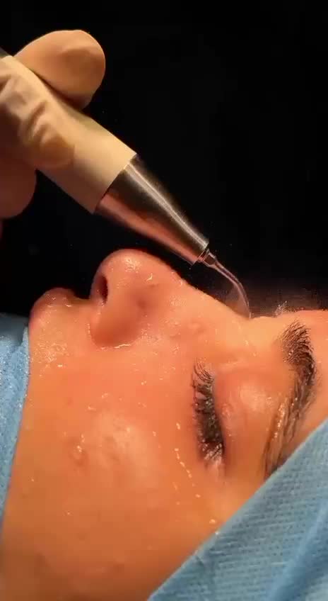 تخفیف ویژه جراحی بینی همین حالا|خدمات آرایشگری و زیبایی|تهران, ازگل|دیوار