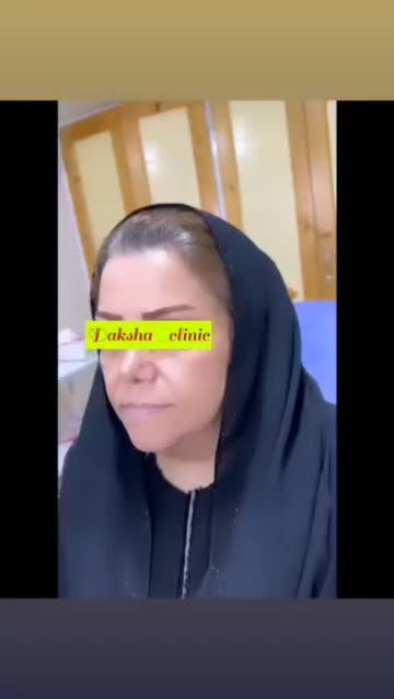 لیفت طبیعی کامل صورت ام دی کد کانتور صورت|خدمات آرایشگری و زیبایی|تهران, میرداماد|دیوار