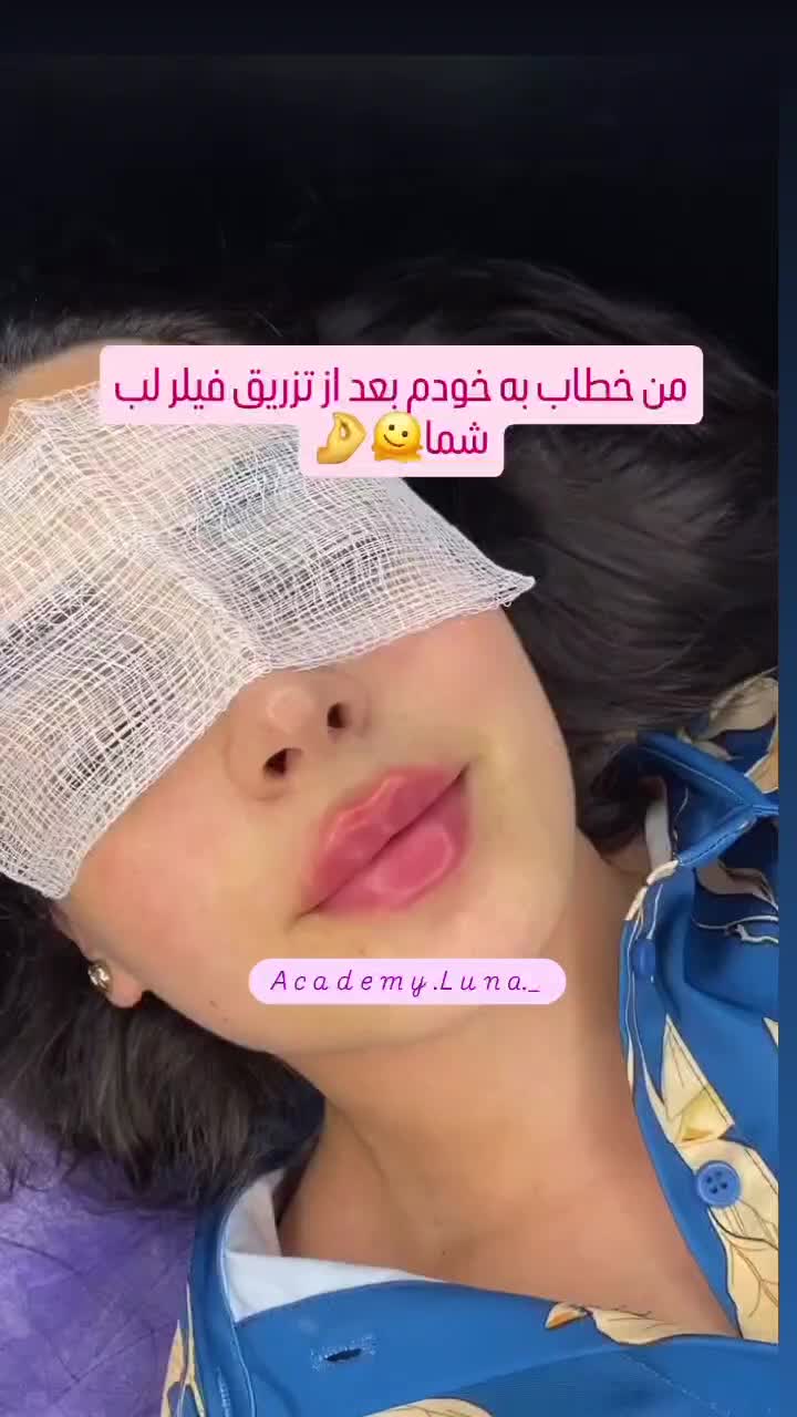 بوتاکس رایگان|خدمات آرایشگری و زیبایی|قم, زنبیل آباد|دیوار