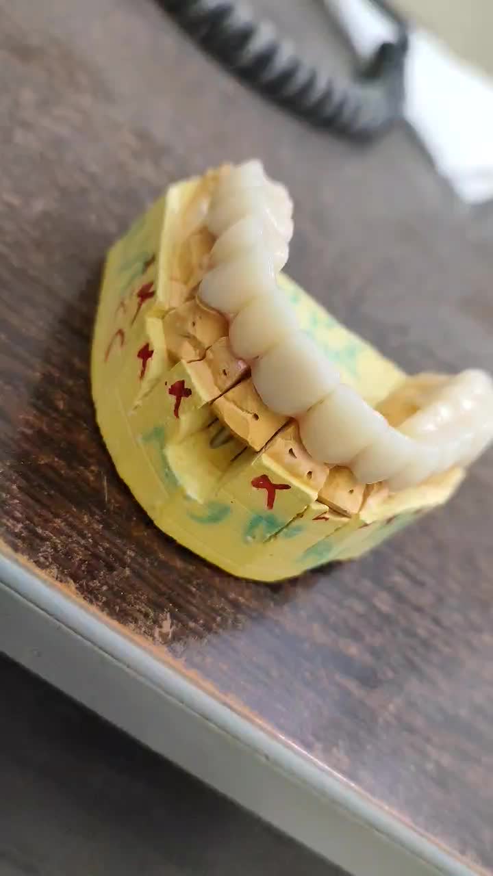 لابراتوار دندانسازی (روکش ثابت)|پزشکی|کرمانشاه, |دیوار