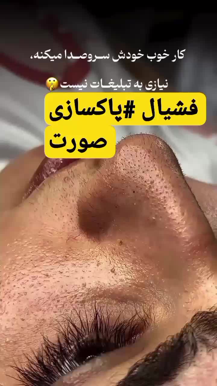 فشیال و پاکسازی صورت|خدمات آرایشگری و زیبایی|اردبیل, |دیوار