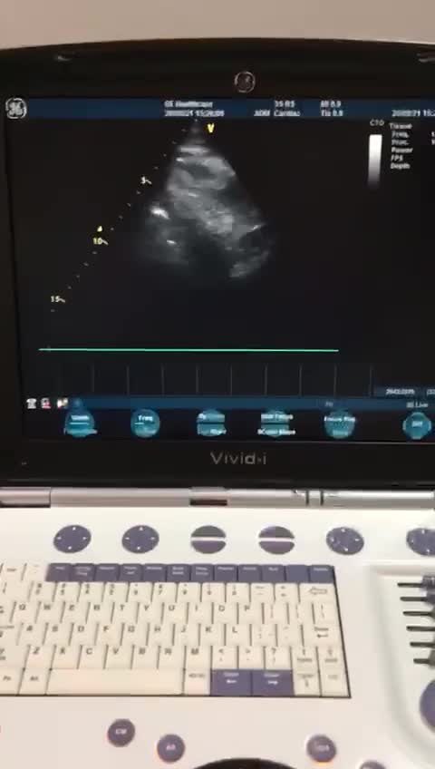 خرید و فروش دستگاه سونوگرافی|پزشکی|تهران, خرمشهر|دیوار