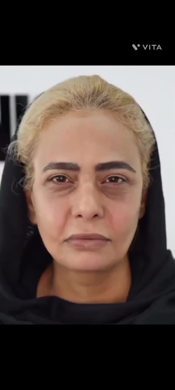 فیلر ژل بوتاکس مزو لیزر هایفو فول فیس ۵۰٪ آف|خدمات آرایشگری و زیبایی|مشهد, فرهنگ|دیوار