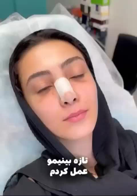 ژل لب بوتاکس مزو سرصورت جالپرو سوپرهیدرو|خدمات آرایشگری و زیبایی|تهران, صادقیه|دیوار