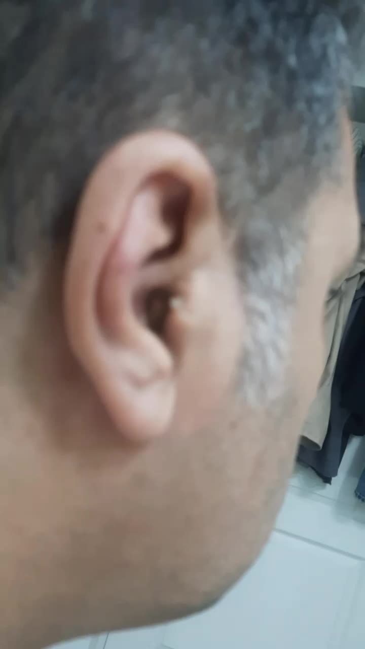 سمعک هوشمند Signia Silk 3X(زیمنس سیگنیا)یک جفت|پزشکی|تهران, بلوار کشاورز|دیوار