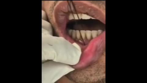 دندان مصنوعی،روکش،ایمپلنت دندانپزشکی دکتر نقوی|خدمات آرایشگری و زیبایی|پیشوا, |دیوار