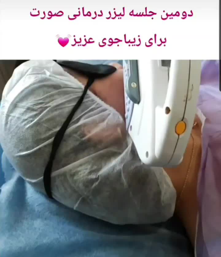 تخفیف ویژه پاییزه لیزر موهای زائد در کلینیک زیبایی|خدمات آرایشگری و زیبایی|رشت, گلسار|دیوار