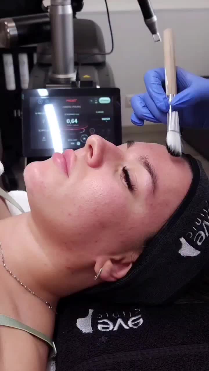 کربن تراپی (پیلینگ هالیودی)در مطب پزشک|خدمات آرایشگری و زیبایی|قم, بلوار امین و ساحلی|دیوار