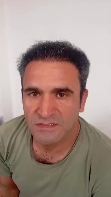 کاشت مووابروشیرازی حرفه ای شروع از۲۰تومن|خدمات زیبایی و سلامت|تهران, صد دستگاه|دیوار