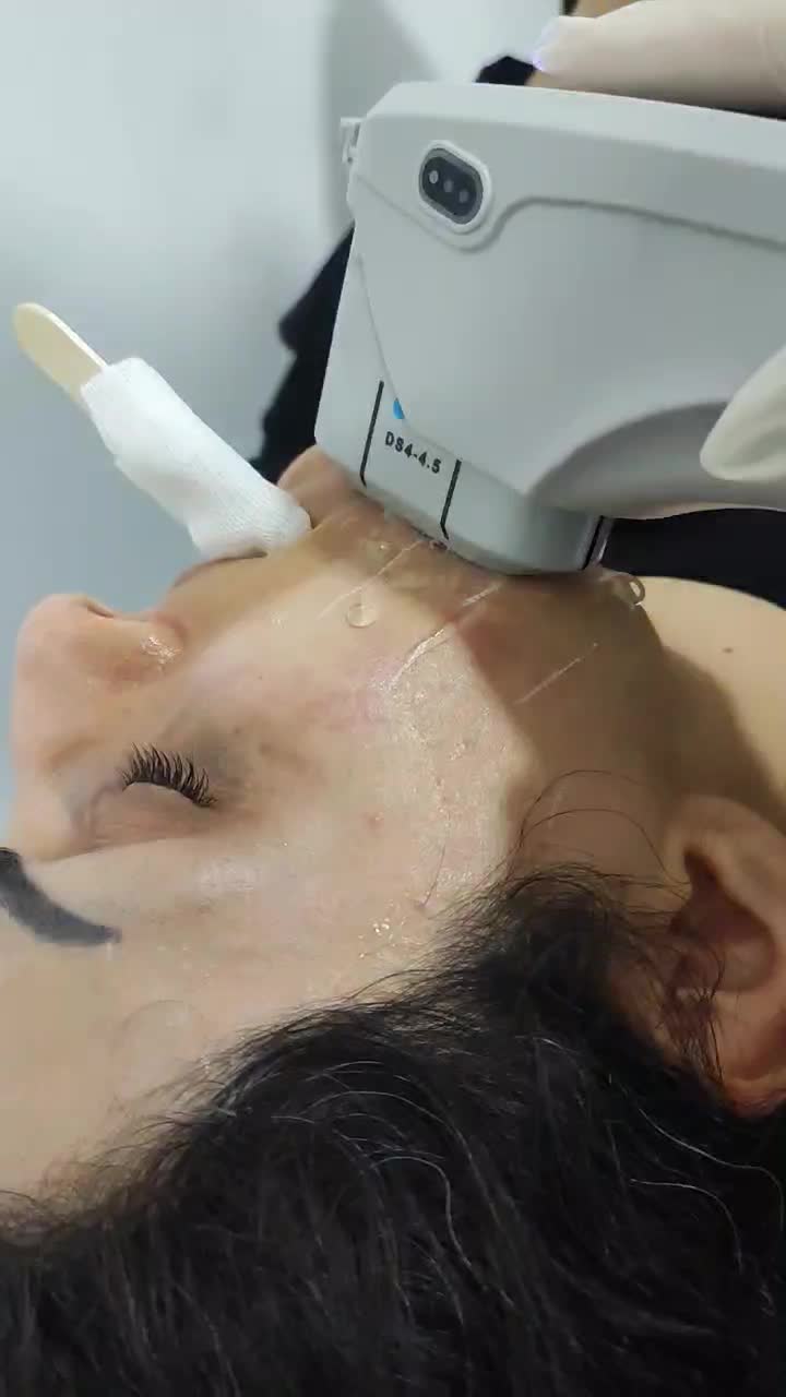 مرکززیبایی و لیزر آکو|خدمات آرایشگری و زیبایی|اندیمشک, |دیوار