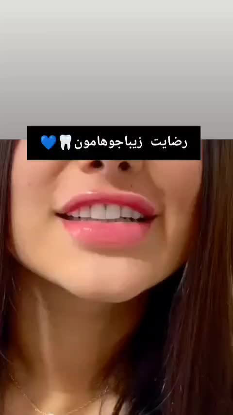 جشنواره کامپوزیت 8000 م ،عصب کشی از۲۵۰۰ توسط پزشک|خدمات آرایشگری و زیبایی|رشت, دروازه لاکان|دیوار