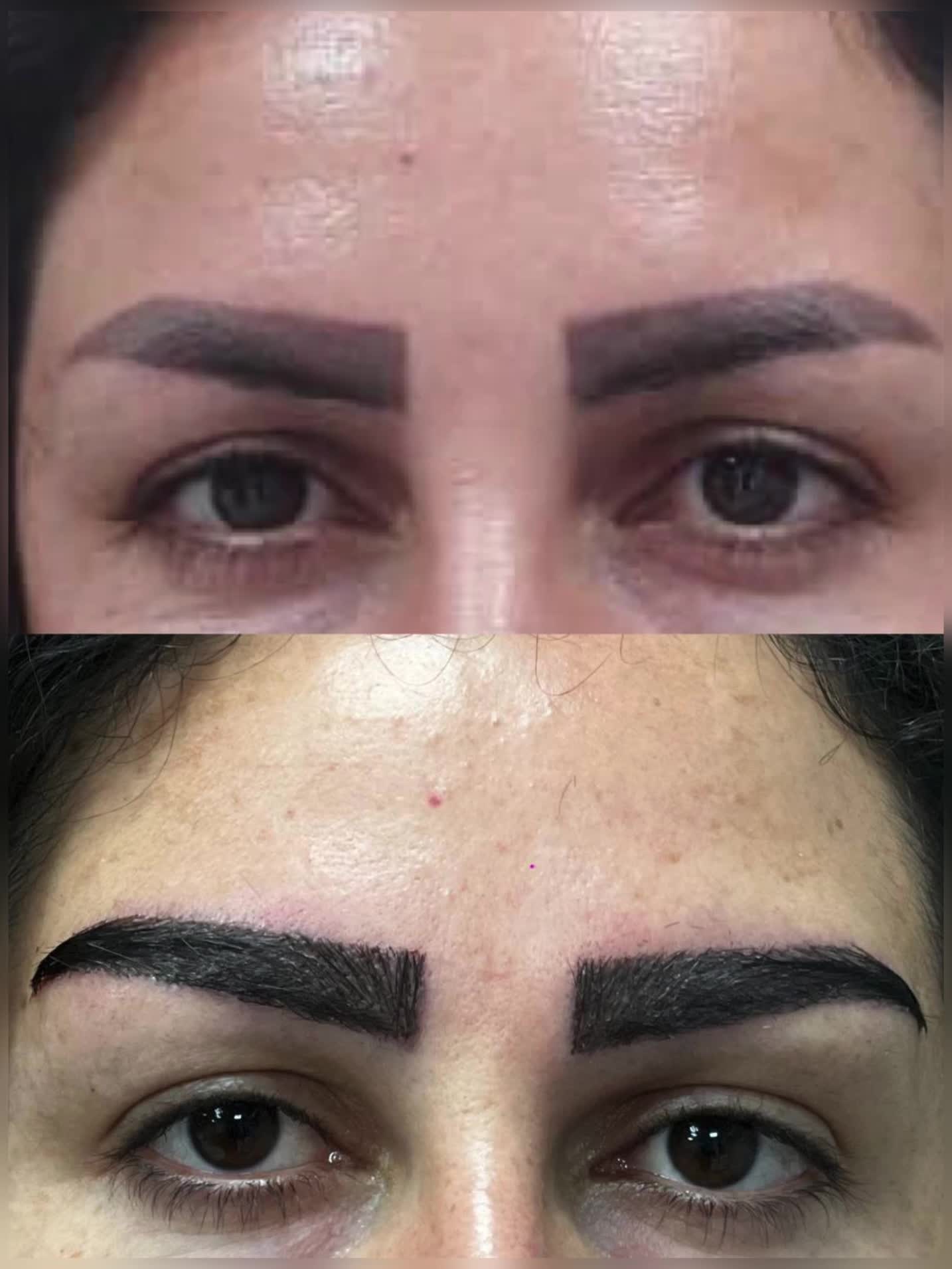 فرصت بسیارویژه لیزر ،هایفوتراپی ،ژل بوتاکس ،منظریه|خدمات آرایشگری و زیبایی|فردیس, منظریه|دیوار