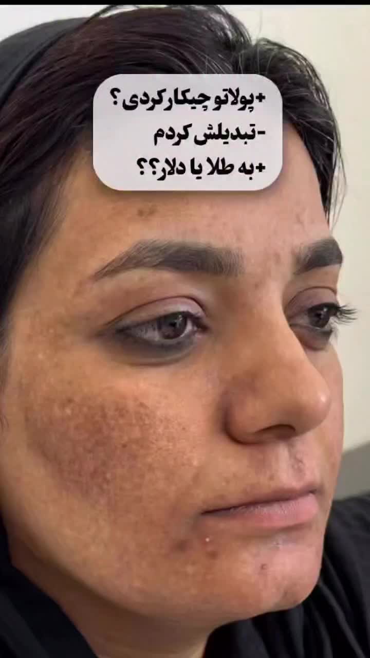 کلینیک تخصصی اپانا لیزر ده بزرگی روشن سازی و..|خدمات زیبایی و سلامت|شیراز, فرهنگ شهر|دیوار