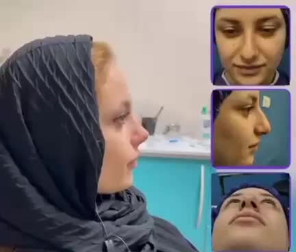 عمل بینی|خدمات آرایشگری و زیبایی|خرمآباد, |دیوار
