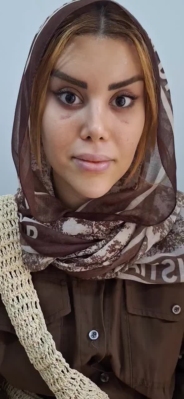 اندولیفت جراحی لیفت شقیقه گونه ابروچشم مینی بلفارو|خدمات زیبایی و سلامت|تهران, بلوار کشاورز|دیوار