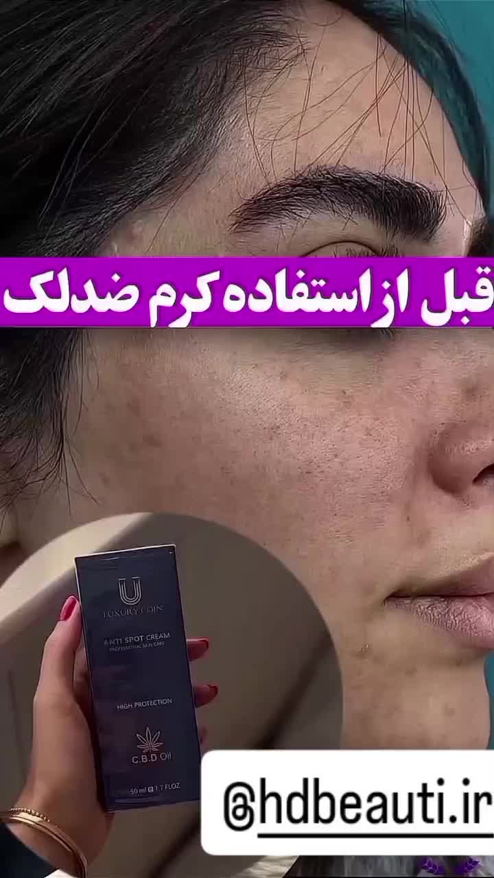 کرم ضد لک لاکچری|آرایشی، بهداشتی، درمانی|تهران, چیتگر جنوبی|دیوار