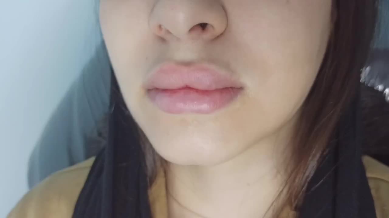 تزریق ژل فیلر لب،گونه،چانه،زاویه،بینی|خدمات آرایشگری و زیبایی|رشت, رشتیان|دیوار