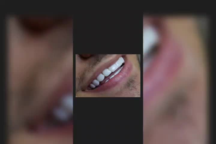 دنتال لند|خدمات آرایشگری و زیبایی|کرمانشاه, |دیوار