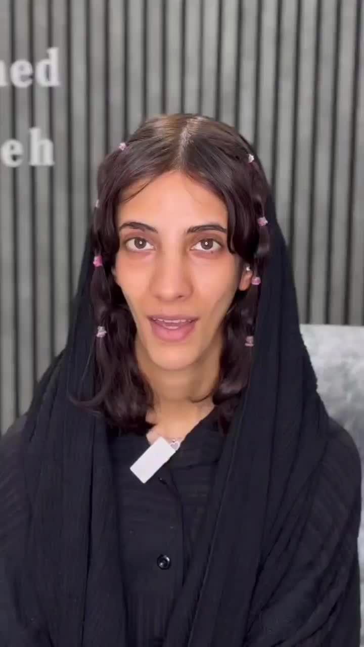 تزریق ژل لب و گونه و چانه.. (جشنواره)درمطب فقط500ت|خدمات آرایشگری و زیبایی|اصفهان, باغ زیار|دیوار