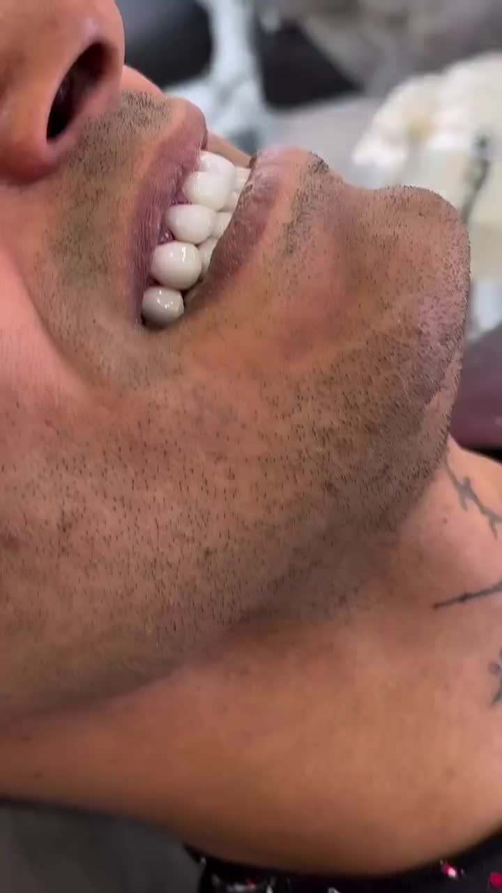 خدمات دندانپزشکی (بانرخ تامین اجتماعی )|خدمات آرایشگری و زیبایی|تبریز, |دیوار