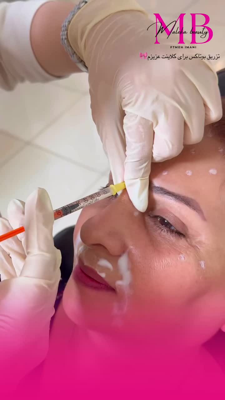 تزریقات ژل‌ لب زاویه فک و بوتاکس با بهترین متریال|خدمات آرایشگری و زیبایی|مشهد, توس (بلوار توس)|دیوار