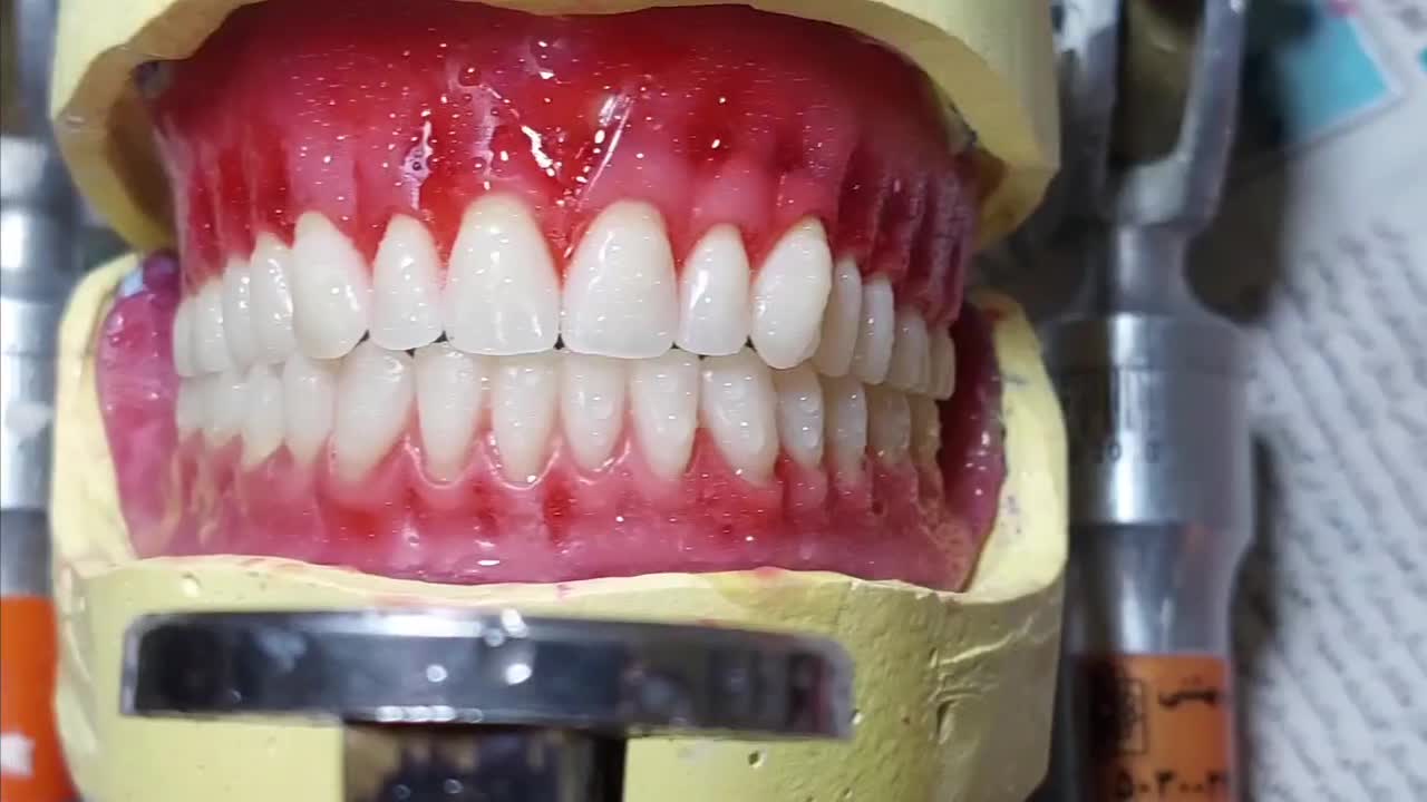 دندان مصنوعی با بیمه تامین اجتماعی اقساط|خدمات زیبایی و سلامت|تهران, آشتیانی|دیوار