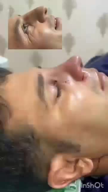 عمل زیبایی بینی با بهترین متد|خدمات آرایشگری و زیبایی|کرج, اتحاد|دیوار