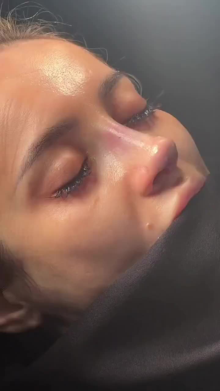 جراحی بینی با تخفیف ویژه (فقط تا پایان شهریور ماه)|خدمات زیبایی و سلامت|تهران, نظامی گنجوی (توانیر)|دیوار
