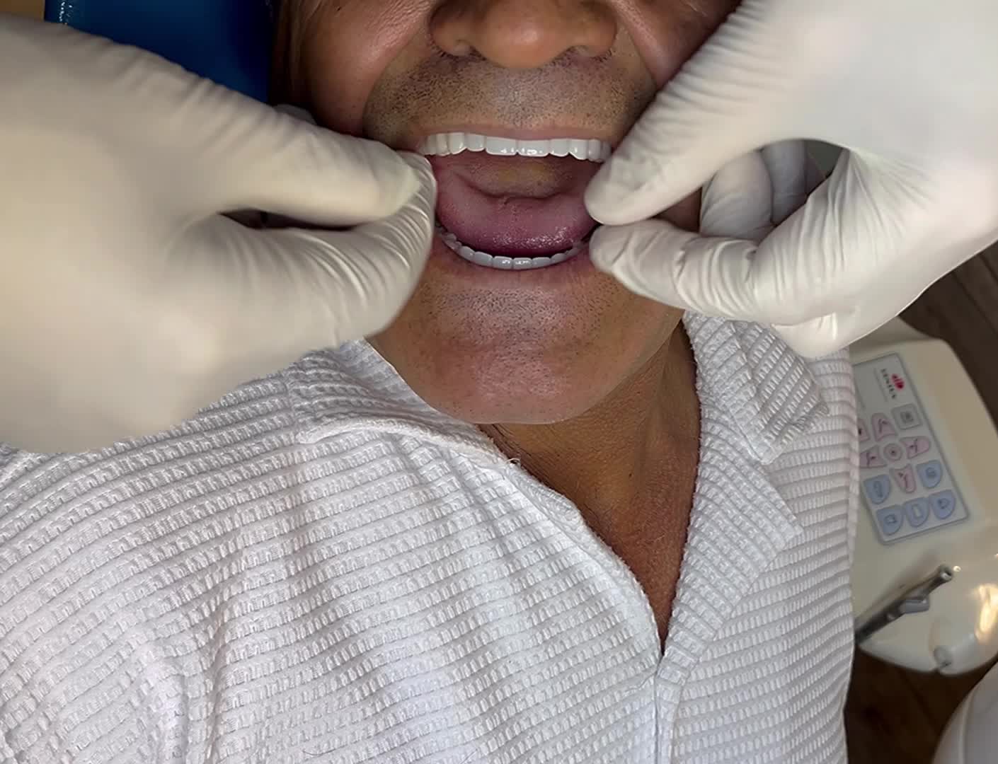 انجام دندان مصنوعی در پنج روز (تضمینی)|خدمات آرایشگری و زیبایی|تهران, تهرانپارس غربی|دیوار