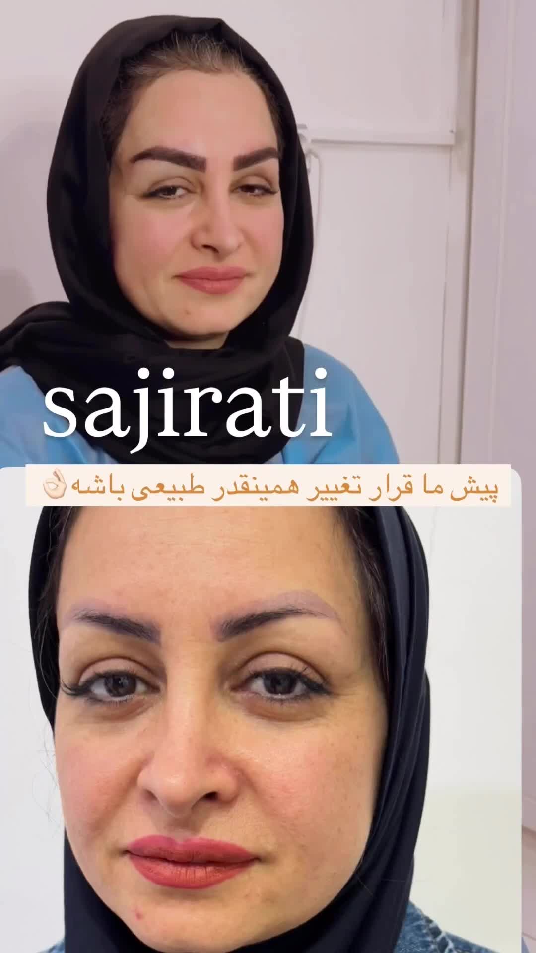 کاشت ابرو تخصصی در درمانگاه کمیل|خدمات آرایشگری و زیبایی|اهواز, زیتون کارمندی|دیوار