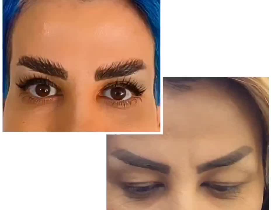 بوتاکس ژل لیفت نخ جراحی پلک چربی پی آرپی اندولیفت|خدمات زیبایی و سلامت|اصفهان, مولوی|دیوار