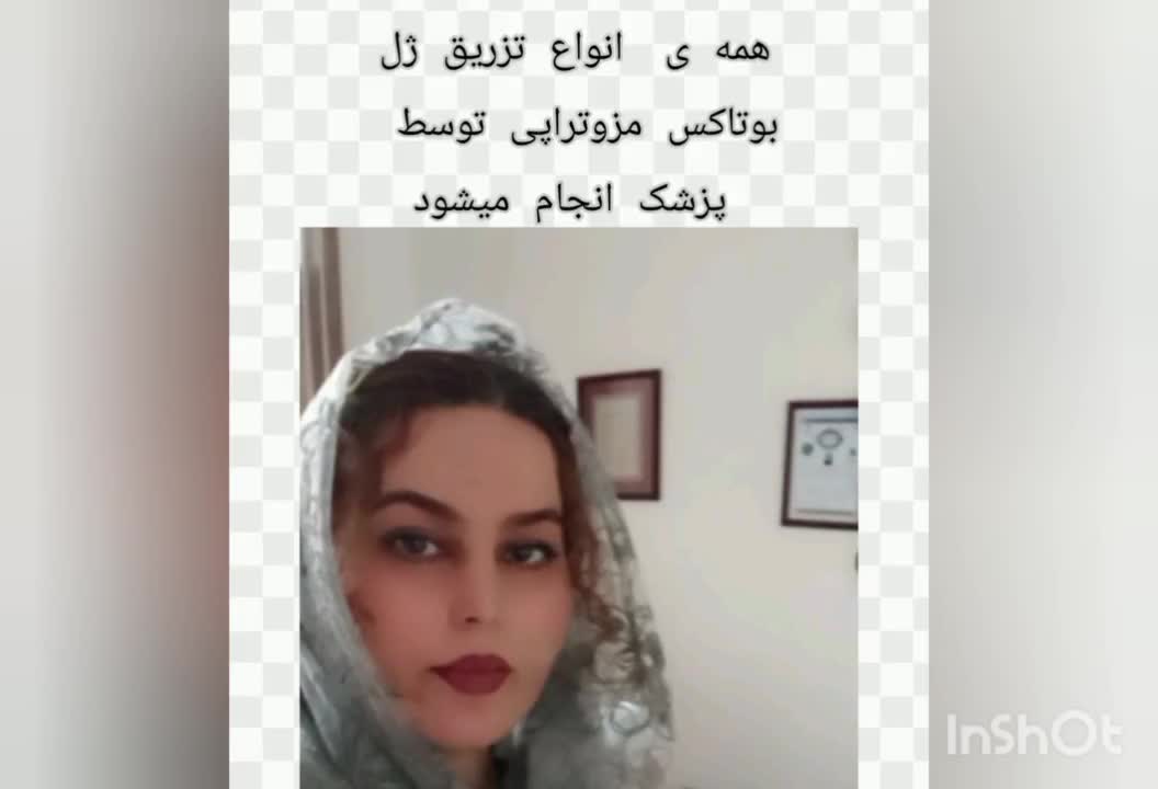 مطب زیبایی دکتر کژال شاه ویسی تزریق ژل بوتاکس..|خدمات آرایشگری و زیبایی|سنندج, |دیوار