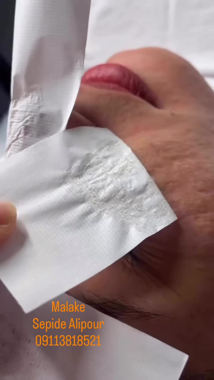 لیزر موهای زائد|خدمات آرایشگری و زیبایی|رشت, سعدی (تختی)|دیوار