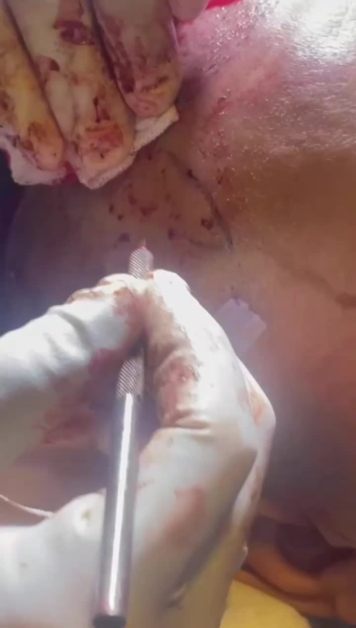 (تخفیف استثنایی کاشتمو)۱۳میلیون(بهعلت قطعیاینترنت)|خدمات آرایشگری و زیبایی|ساری, |دیوار