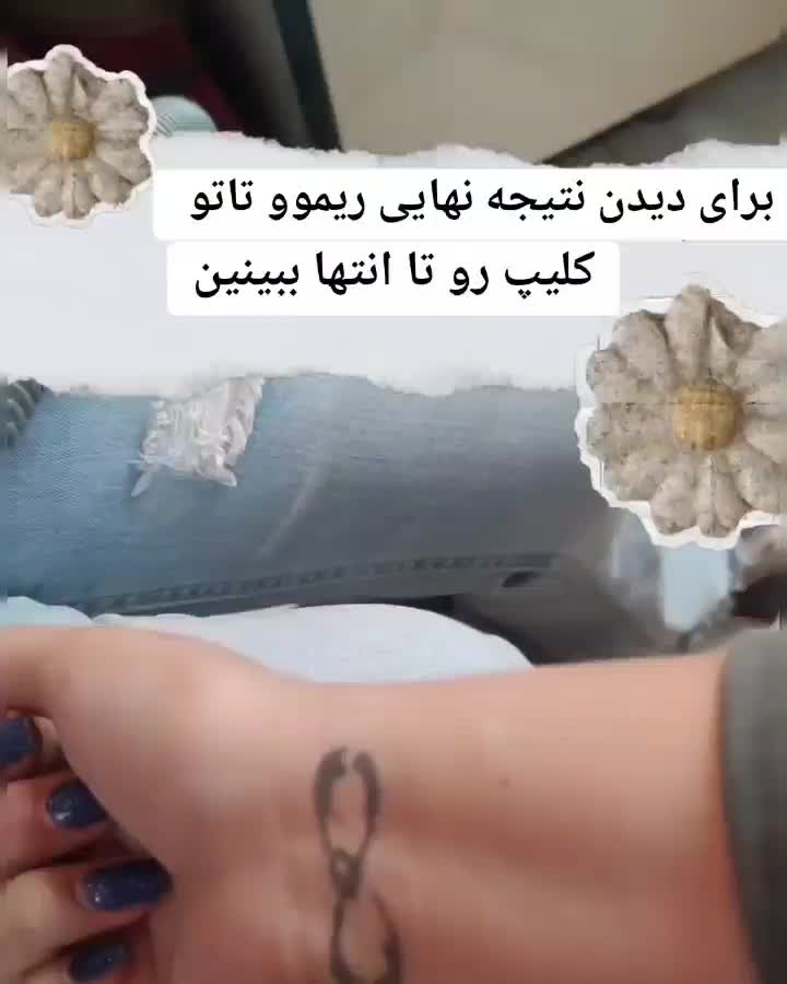 پاک کردن تاتو بدن و صورت با جدیدترین دستگاه لیزر|خدمات آرایشگری و زیبایی|تهران, نازی‌آباد|دیوار