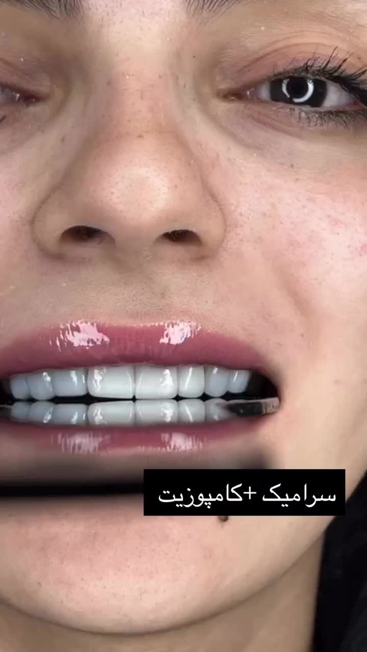 دندانپزشکی لبخند|خدمات آرایشگری و زیبایی|تهران, دهقان|دیوار