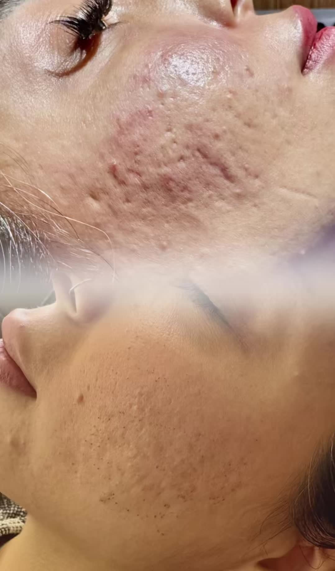 برداشتن گوشت اضافه صورت وبدن|خدمات آرایشگری و زیبایی|اصفهان, کوجان|دیوار