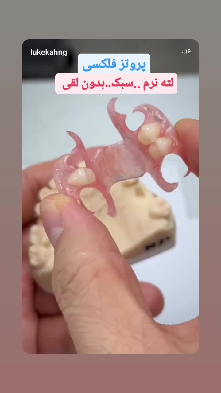 ساخت دندان مصنوعی جلوه طبیعی طرح لبخند|خدمات آرایشگری و زیبایی|سبزوار, امیر کبیر|دیوار