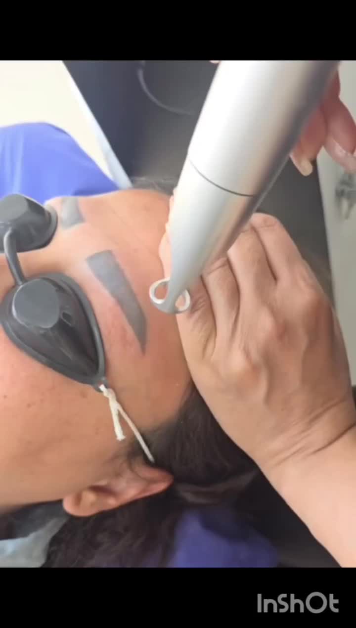 پاککردن تتوی بدن و روشن شدن بیکینی و زیربغل وصورت|خدمات آرایشگری و زیبایی|یاسوج, |دیوار