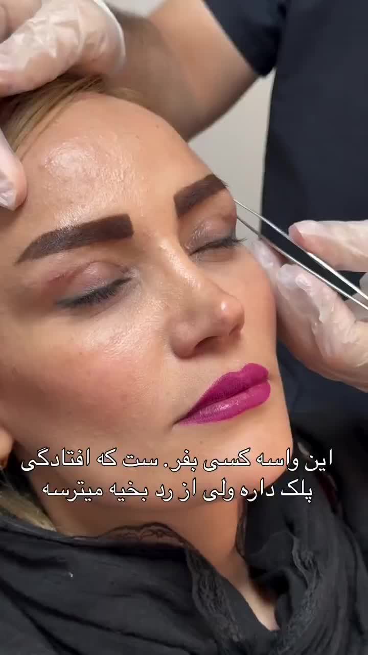 بلفاروپلاستی (جراحی پلک بالا و پایین)|خدمات آرایشگری و زیبایی|یاسوج, |دیوار