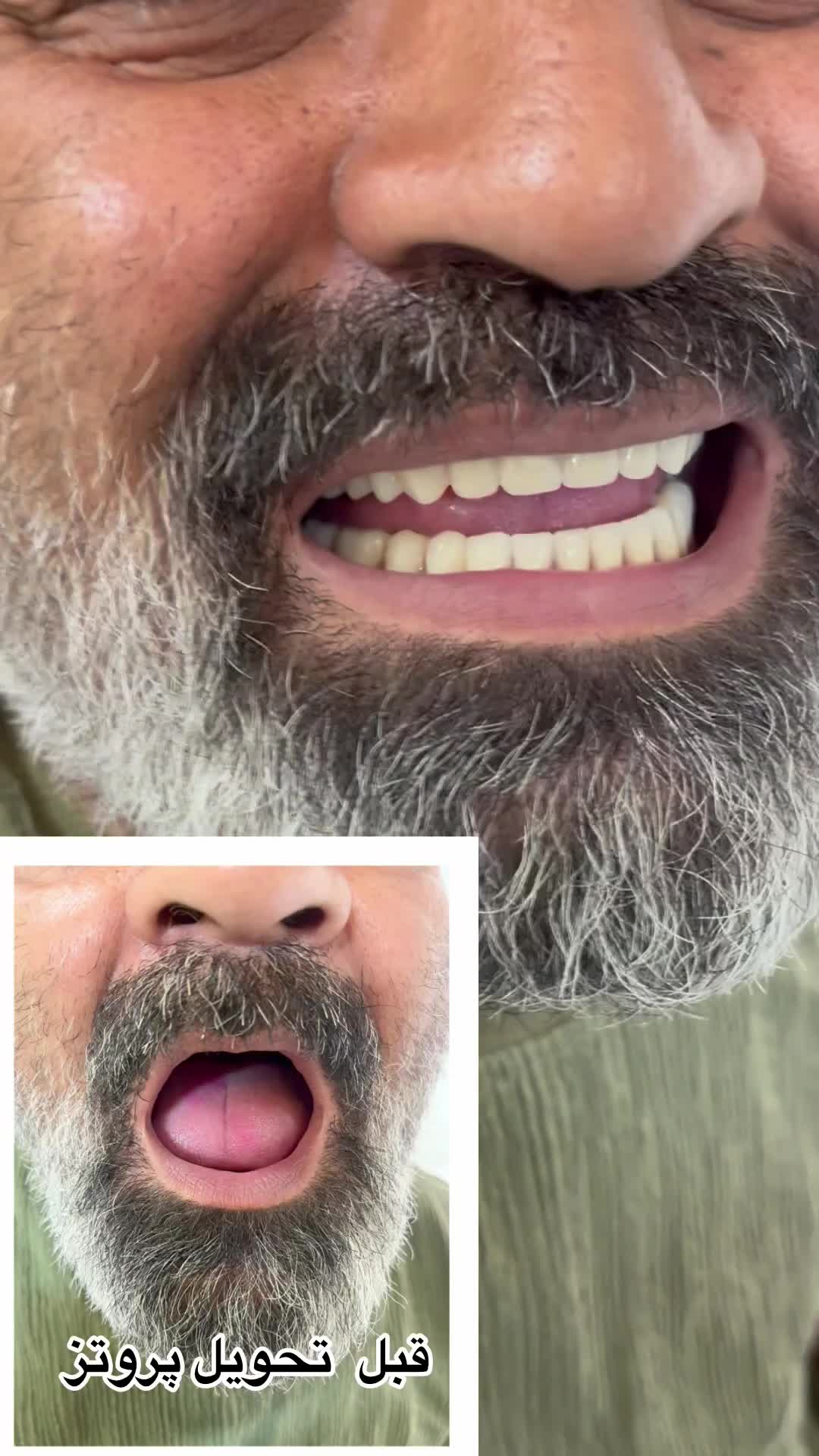 دندان مصنوعی|خدمات آرایشگری و زیبایی|پرند, فاز ۲|دیوار