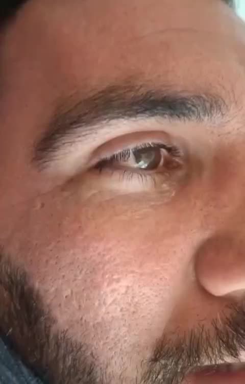 اولین مرکز تخصصی تاتوپزشکی بهشت|خدمات زیبایی و سلامت|تهران, عباسآباد|دیوار
