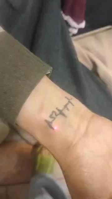 برداشتن خال کک مک منگوله گوشتی لک در یک جلسه ژل|خدمات آرایشگری و زیبایی|گلستان (تهران), |دیوار