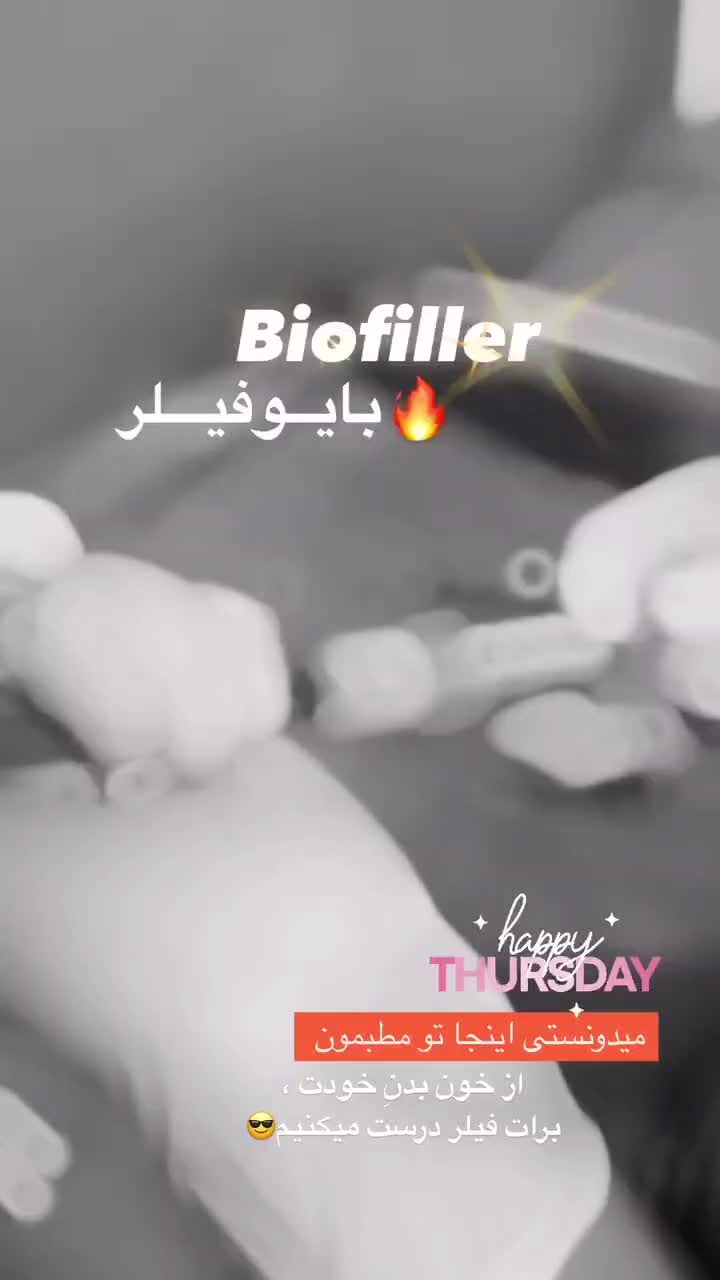 تزریق ژل طبیعی فیلر بوتاکس(کلینیک زیبایی گلد)|خدمات آرایشگری و زیبایی|سنندج, |دیوار