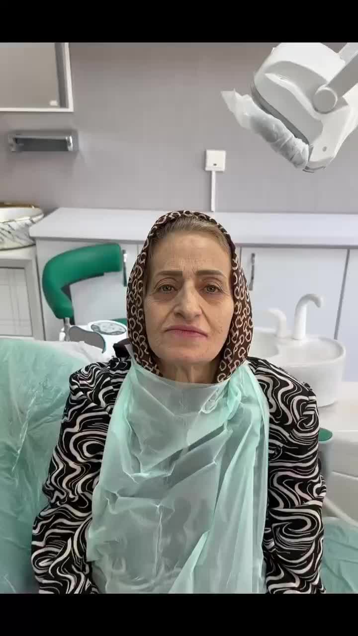 اقساط ویژه ایمپلنت دیجیتال،اوردنچر،دندان مصنوعی..|خدمات زیبایی و سلامت|تهران, دبستان|دیوار